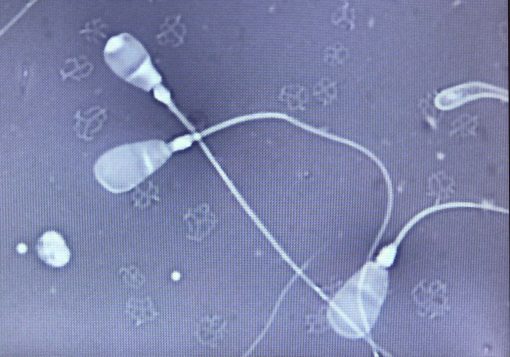 Sperm Morphology: Building a Spermiogram