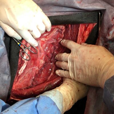 C-Section LIVE Webinar