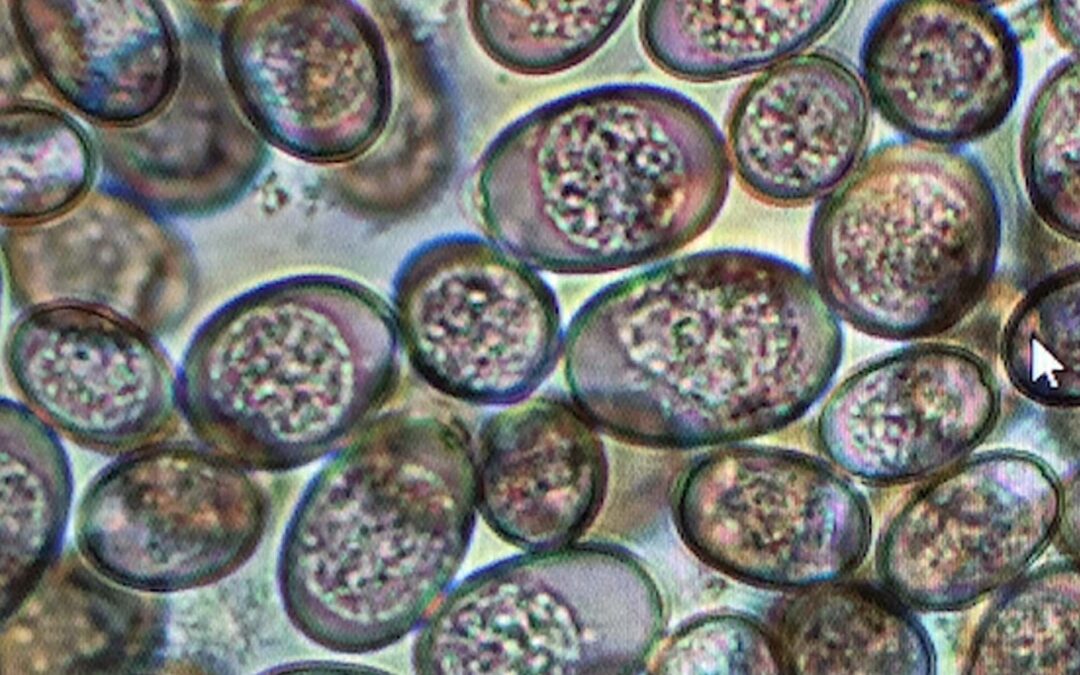Coccidiosis