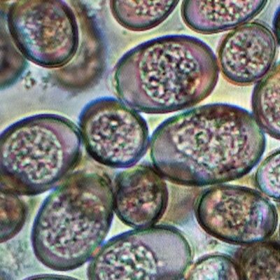 Coccidiosis